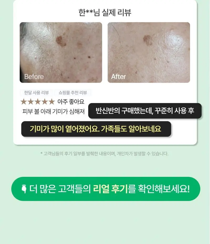 [기미개선] 대웅제약 이지듀 기미잡티앰플 12ml+1ml 기획 상세페이지 12